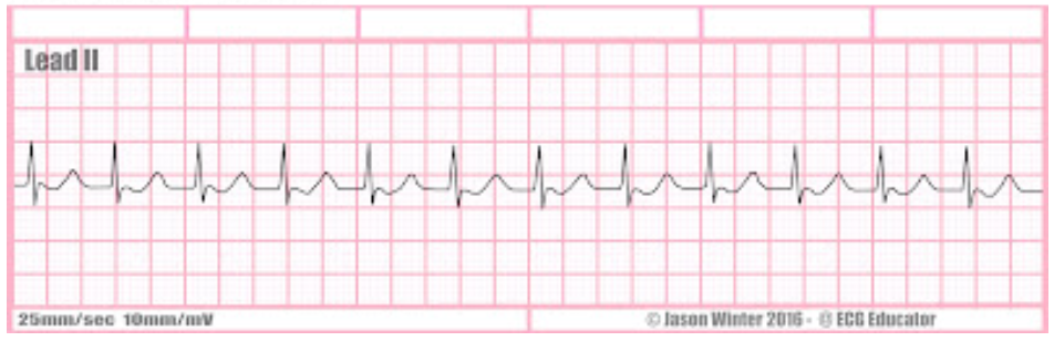 <p>what is this rate + characteristics?</p>