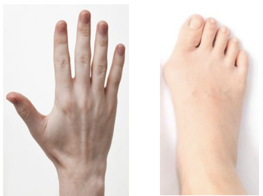 <p>back of the hand/foot</p>