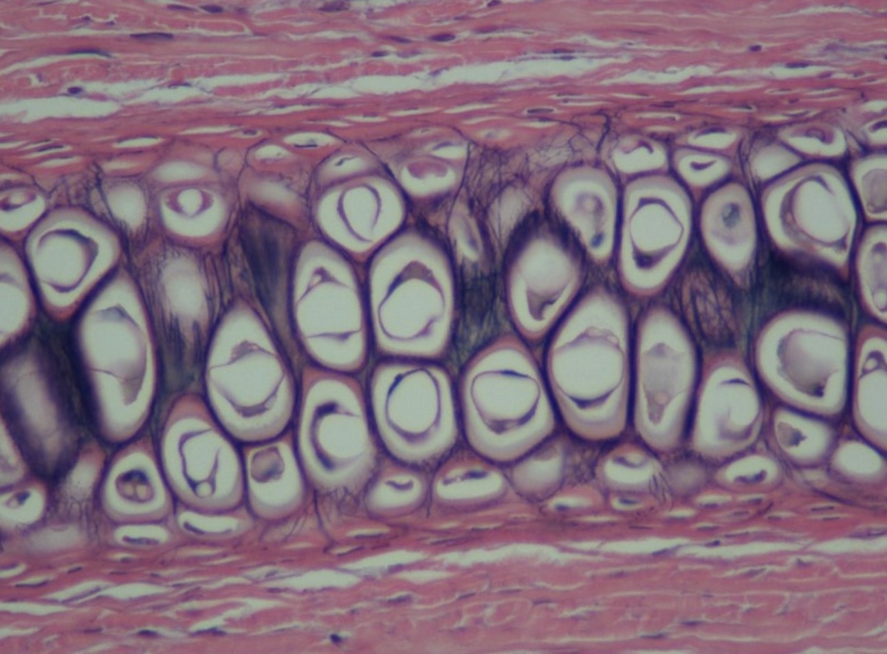 <p>Elastic cartilage </p>