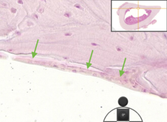 <p>On external bone called : periosteal cells. On internal bone called : endosteal cells.</p>