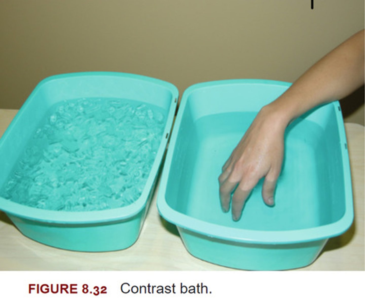 <p>-Hydrotherapy used to achieve the benefits of heat including decreased pain and increased flexibility while avoiding increase edema.</p><p>-The Varying sensory stimulus is thought to promote pain relief and desensitization</p>