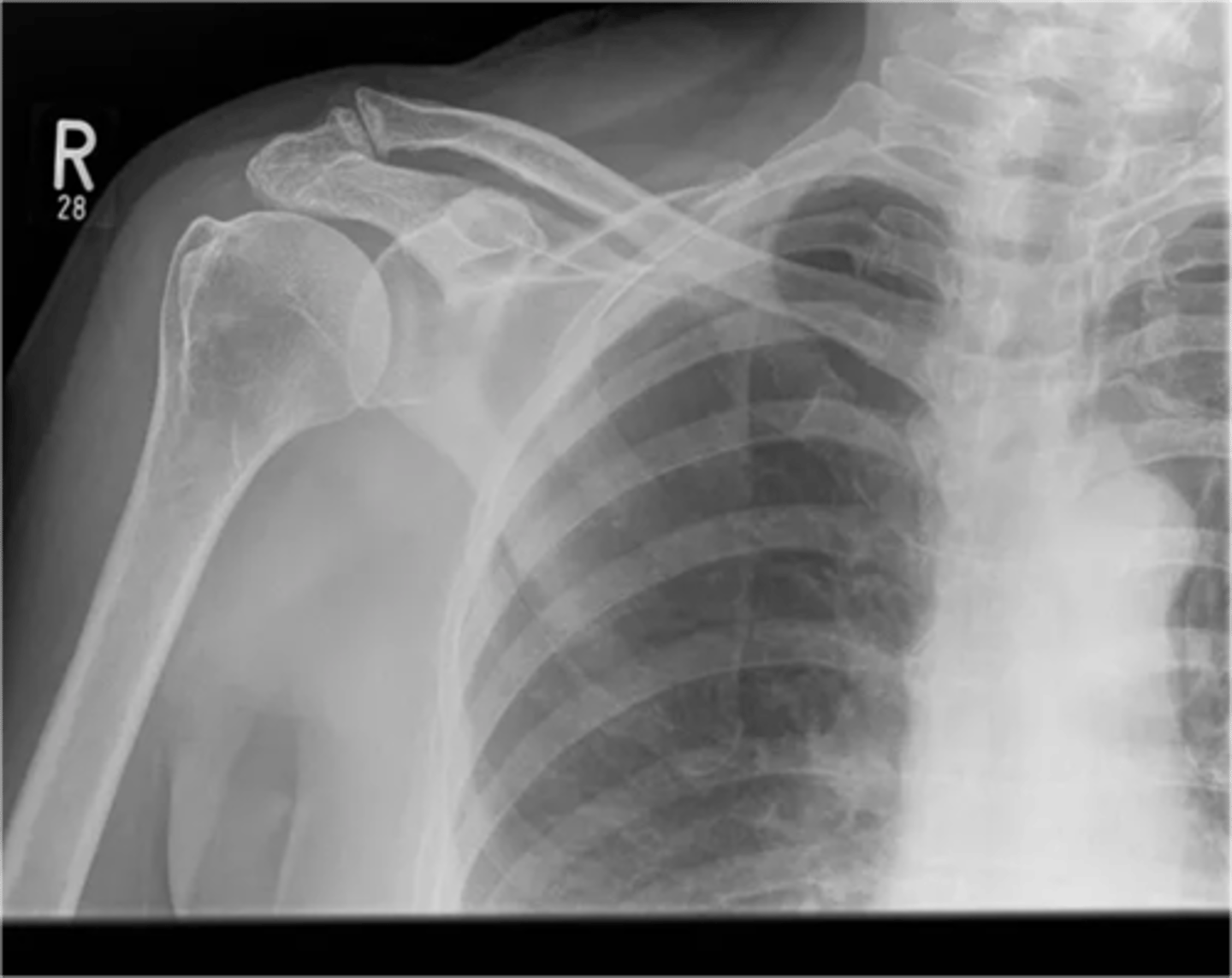 <p>What is this image depicting? How do you know?</p>