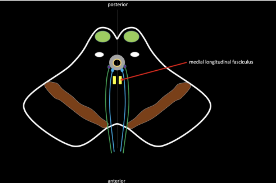 <p>Medial Longitudinal Fasciculus</p>