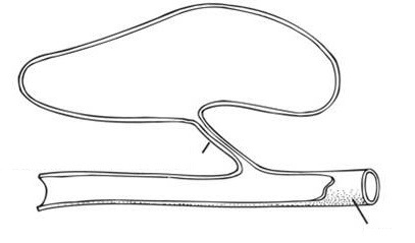 <p>Gas bladder is attached to the gut by pneumatic duct</p><p>-Sturgeons and primitive fishes</p><p>-inflate by gulping air or diffusion of gases from blood into bladder by gas gland</p><p>-Release gas through pneumatic duct</p>