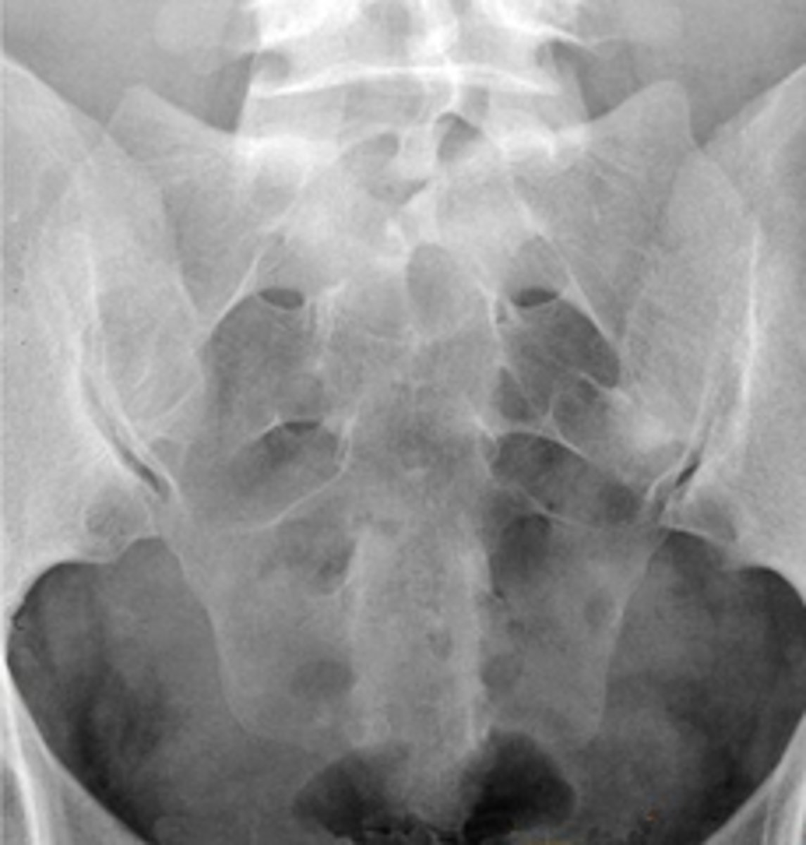 <p>What position/projection?</p>