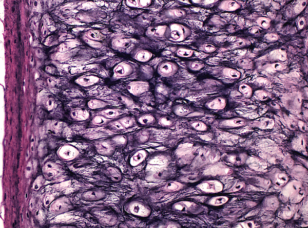 <p>What kind of Cartilage is this?</p>