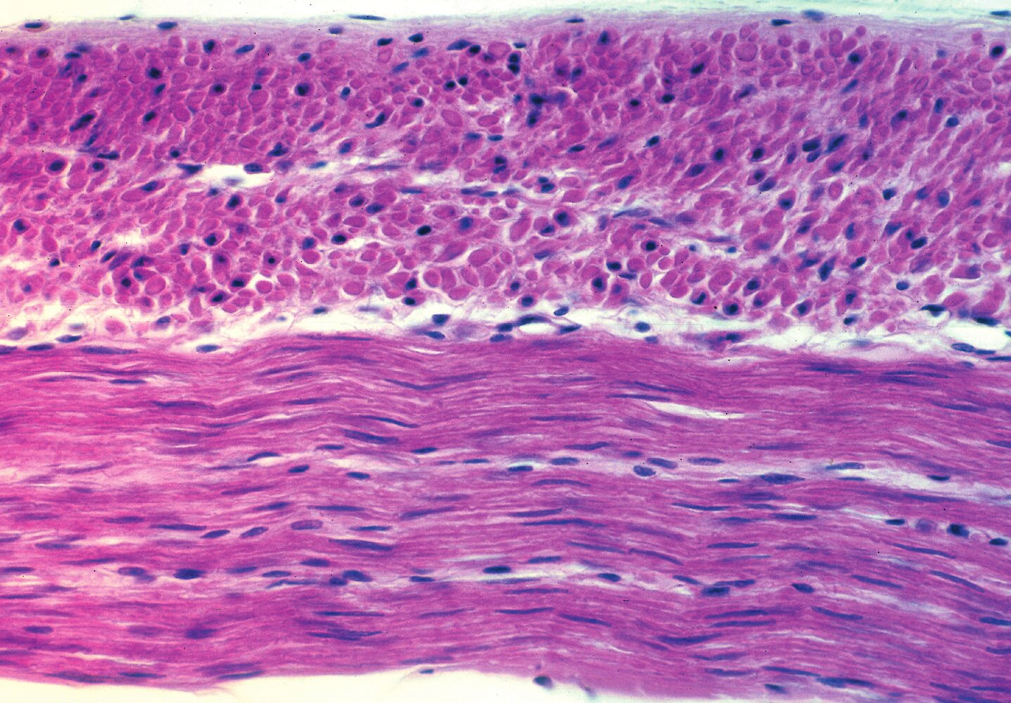 <p>18. The image shows a histological preparation in which a specific type of muscle cells predominates.</p><p>What characterizes the muscle cells shown?</p><p>A. Their caveolae serve, among other things, to take up Ca²⁺ into the cell.</p><p>B. Their contraction is triggered by binding of Ca²⁺ to troponin C.</p><p>C. Their postsynaptic cell membrane contains clusters of nicotinic acetylcholine receptors.</p><p>D. Their abundant intermediate filament proteins are called cytokeratins.</p><p>E. Their cell membranes are invaginated as T-tubules at the junction of A and I bands.</p>