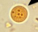 <ul><li><p>5-12 um</p></li><li><p>usually oval shaped</p></li><li><p>4 nuclei</p></li><li><p>prominent karyosome in nuclei</p></li><li><p>granular, vacuolated cytoplasm</p></li></ul><p></p>