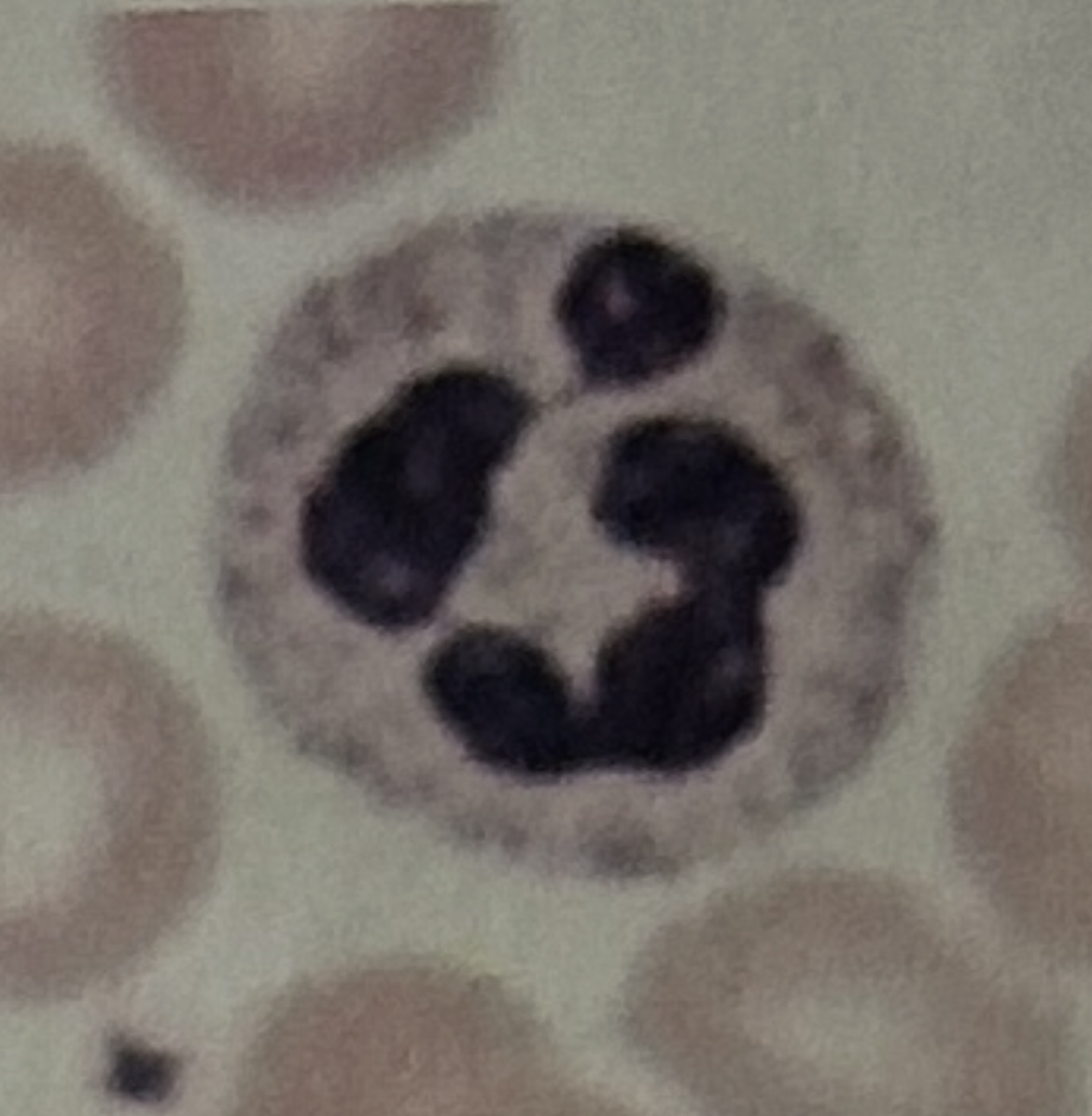 <p>WBC</p>
