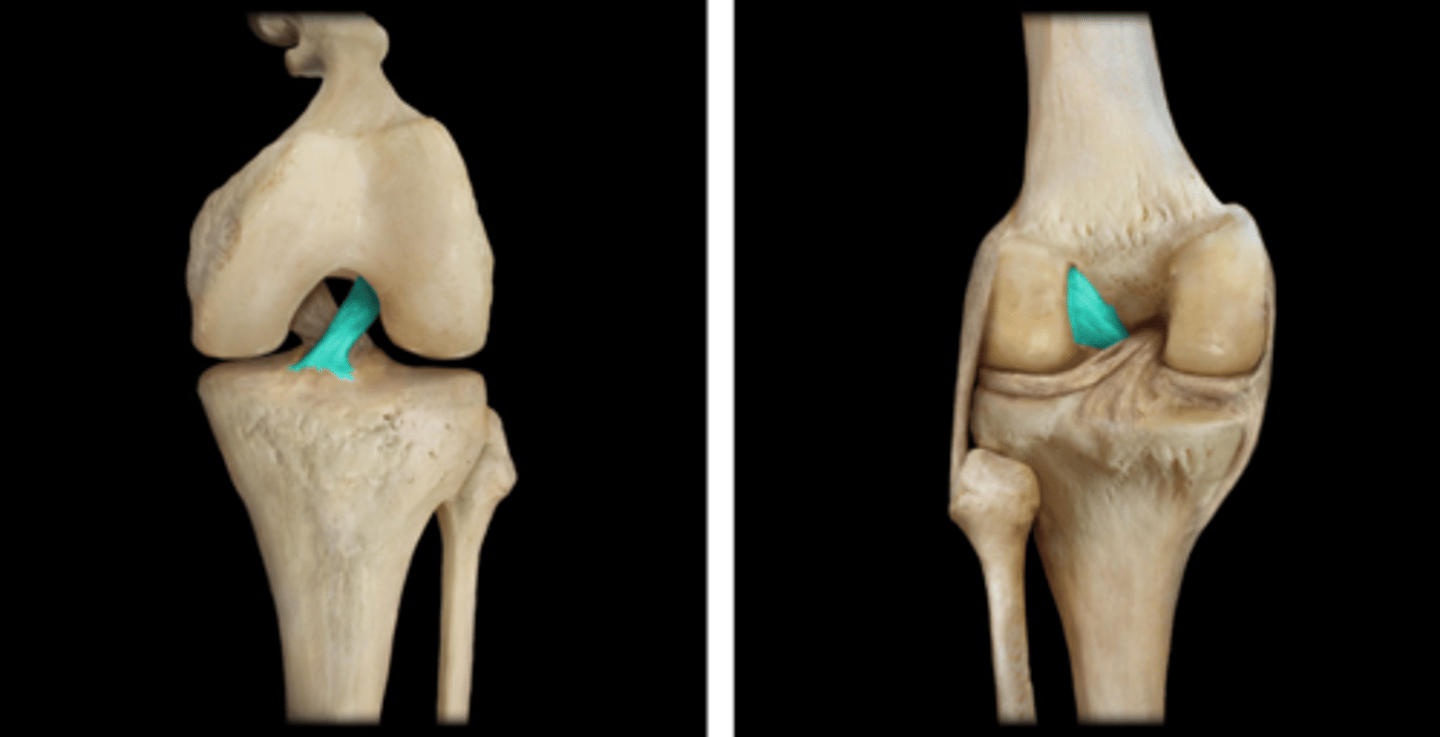 <p>Name this connective tissue structure.</p>