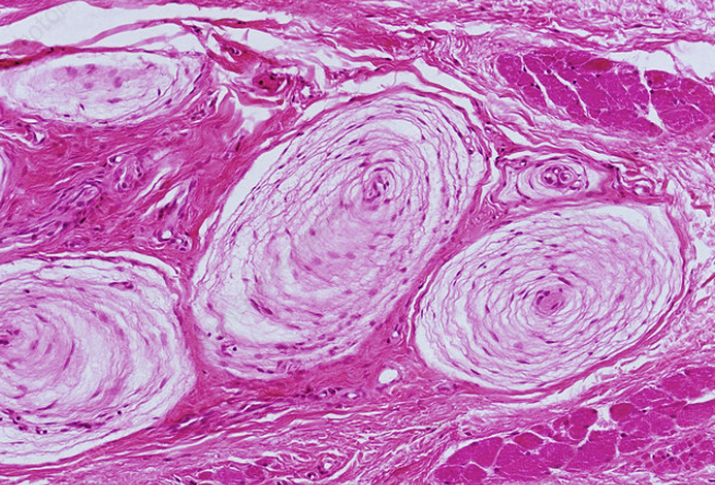 <p>Specialized nerve endings, also known as lamellar corpuscles, that are sensitive to vibration and pressure</p>