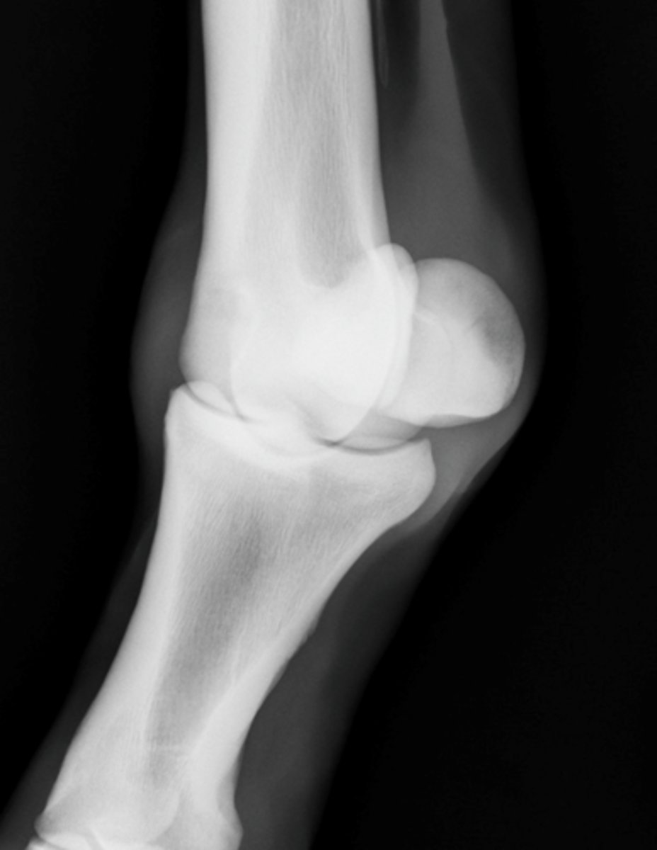 <p>What is highlighted in a DLMPO view of the fetlock?</p>