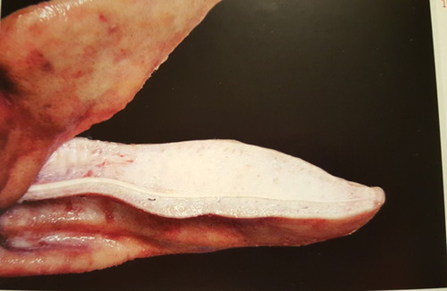<p>Øre fra svin. Patoanatomisk diagnose? Ætiologi?</p>