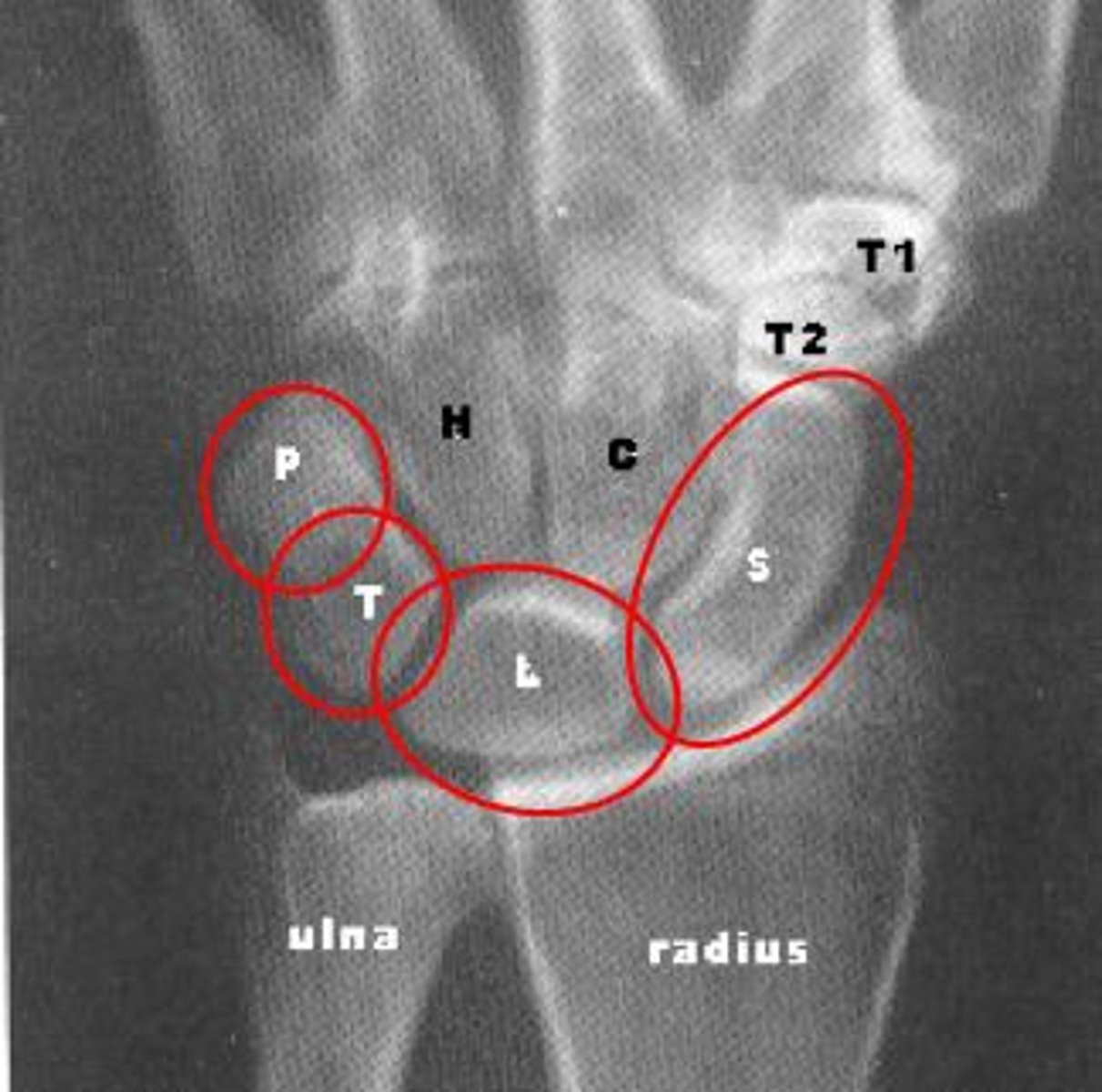 <p>scaphoid, lunate, triquetrum, pisiform</p>