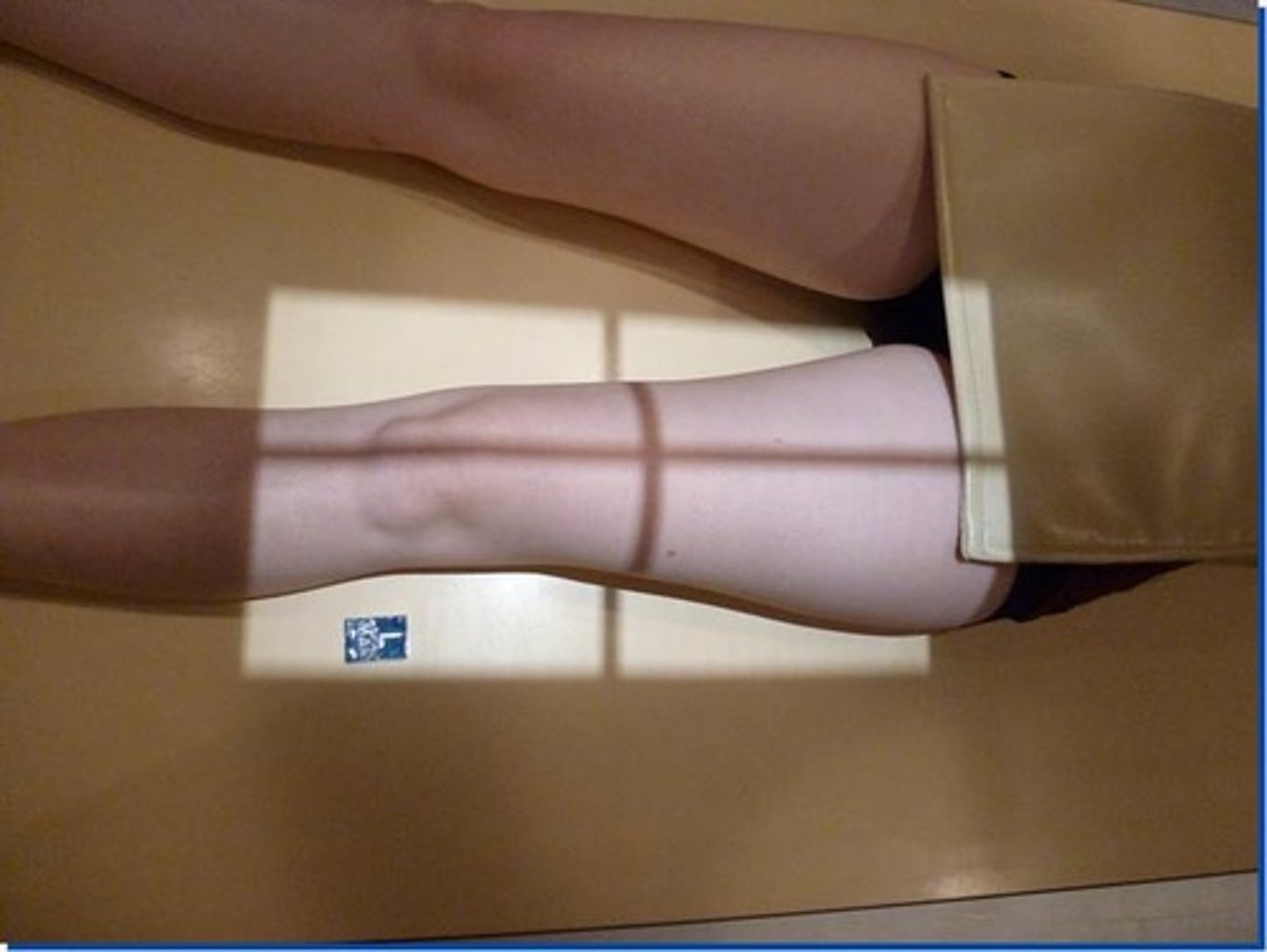 <p>SID: 100 - 115cm</p><p>Central ray: perpendicular to the IR</p><p>Centring point: midline of the femur, midway between knee &amp; hip joint.</p>