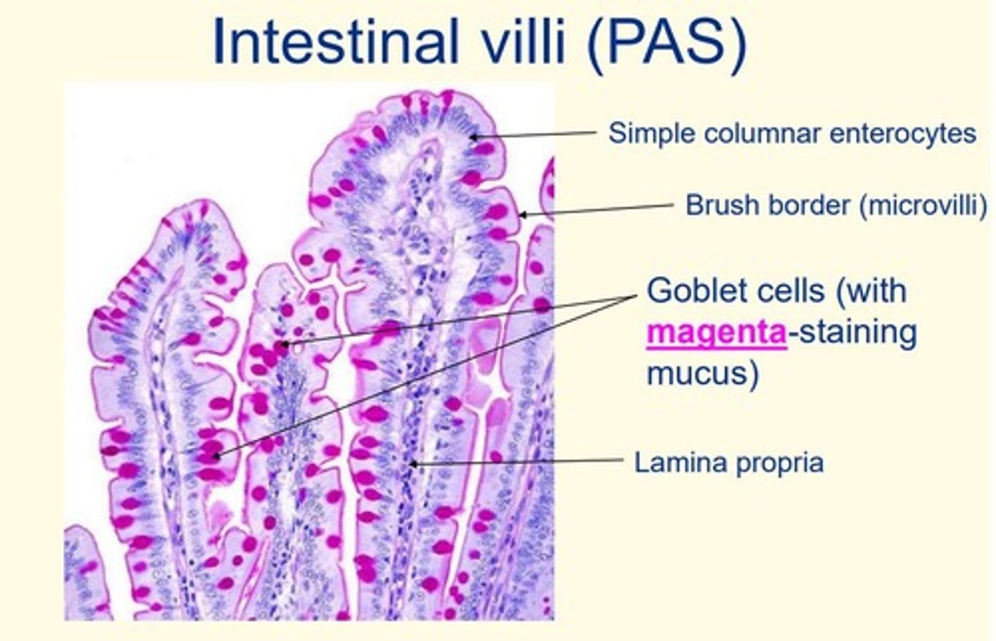 <p>Note = the goblet cells are stained magenta (due to mucus)</p>