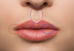 <p>what are the circles</p>