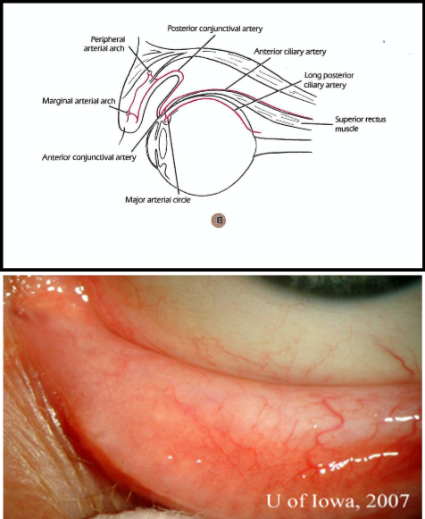 <ul><li><p>Palpebral conj - marginal and peripheral palpebral arcades (artery)</p><ul><li><p>palpebral arteries originate from medial and lateral palpebral arteries and anastomose in eyelid</p></li><li><p>small collateral branches connect arcades to the tarsal plate</p></li><li><p>collateral arteries give it pinkish-red color</p></li></ul></li></ul><p></p><p></p>