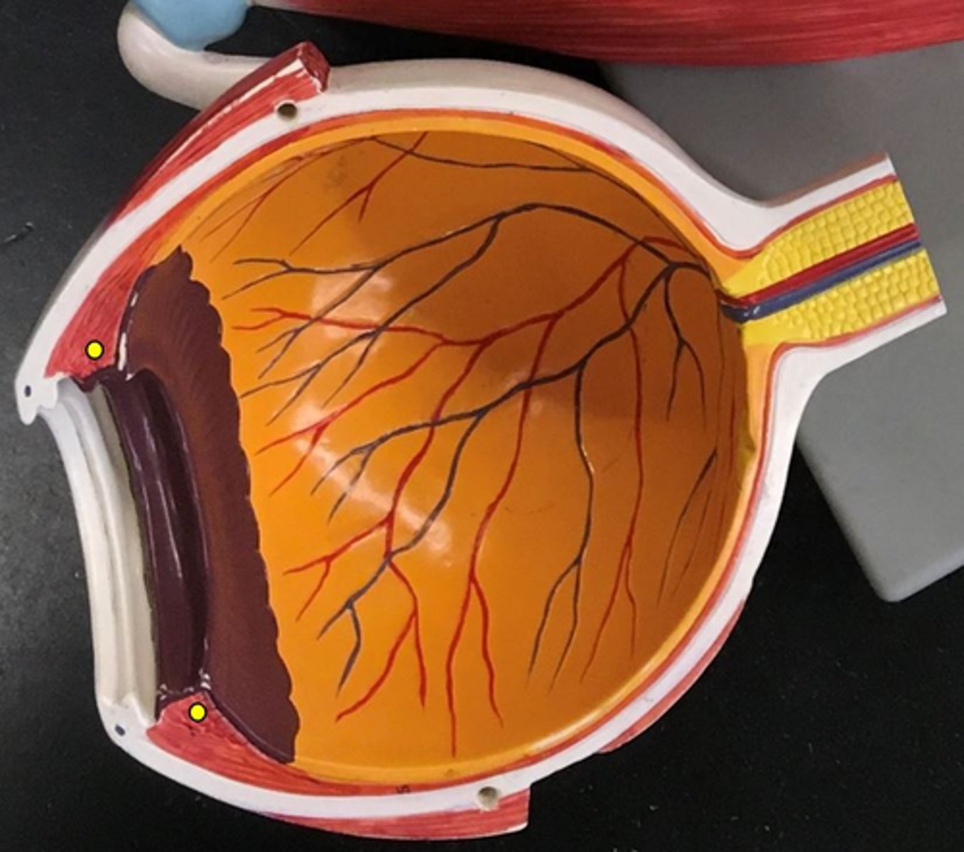 <p>- Red dots that are attached to the iris</p>