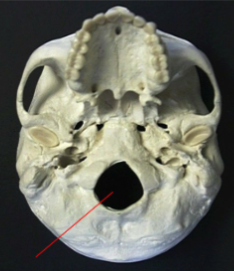 <p>Which occipital bone marking is this? (1)</p>