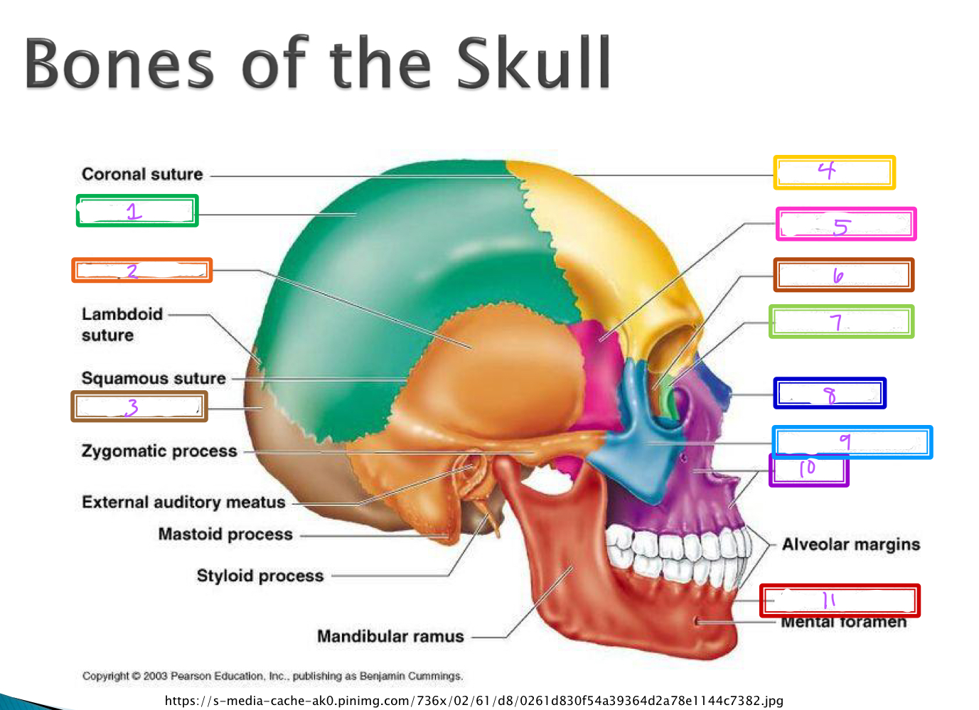 What bone is indicated by the number 10 in the image?