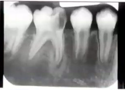 <p>what is the diagnosis?</p>