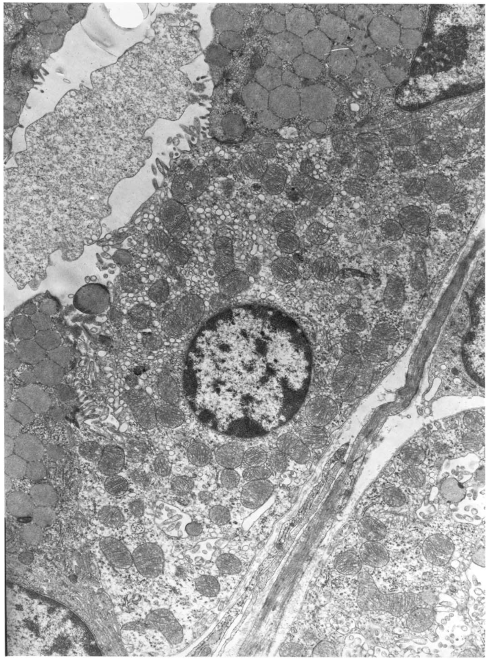 <p>Identify</p><ol><li><p>The cell membrane </p></li><li><p>The nucleus and nuclear envelope </p></li><li><p>Rough and smooth endoplasmic reticulum </p></li><li><p>Ribosomes </p></li><li><p>Golgi apparatus </p></li><li><p>Mitochondria</p></li><li><p>Vesicles </p></li><li><p>Lysosomes </p></li><li><p>Glycogen granules</p></li></ol><p></p><p><em>Add the drawings of these!!</em></p>