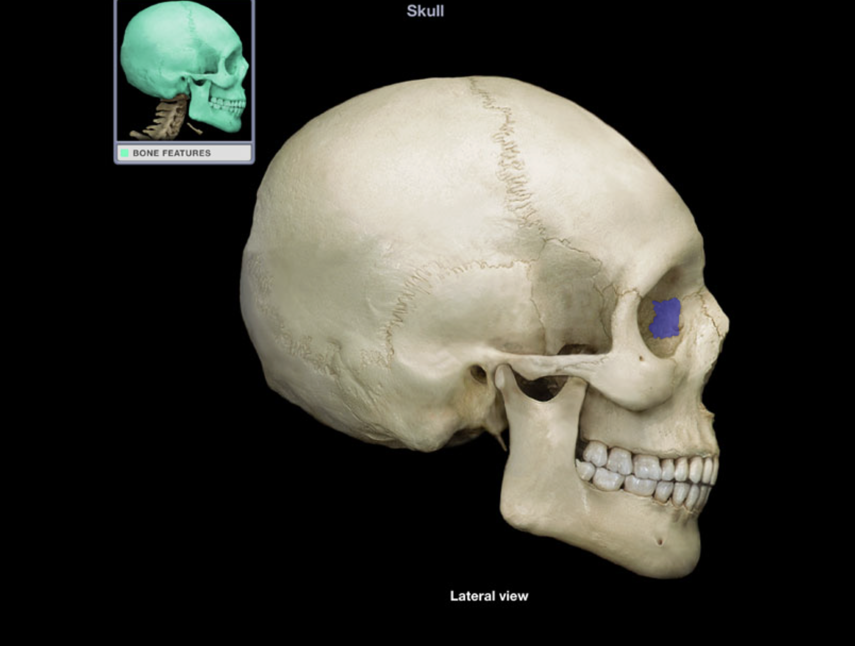 <p>Lacrimal bone</p>