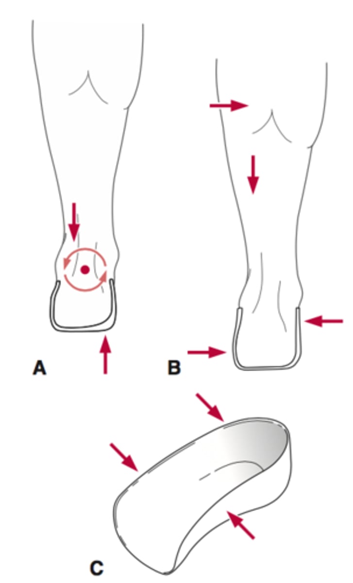 <p>semirigid plastic molded insert to correct for flexible pes planus</p>