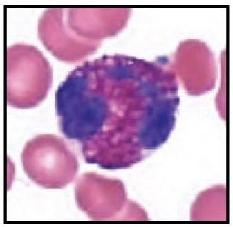 <p>Agranular or Granular</p>