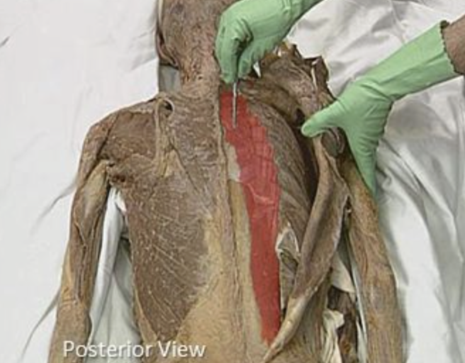 <p>muscle name & action</p>