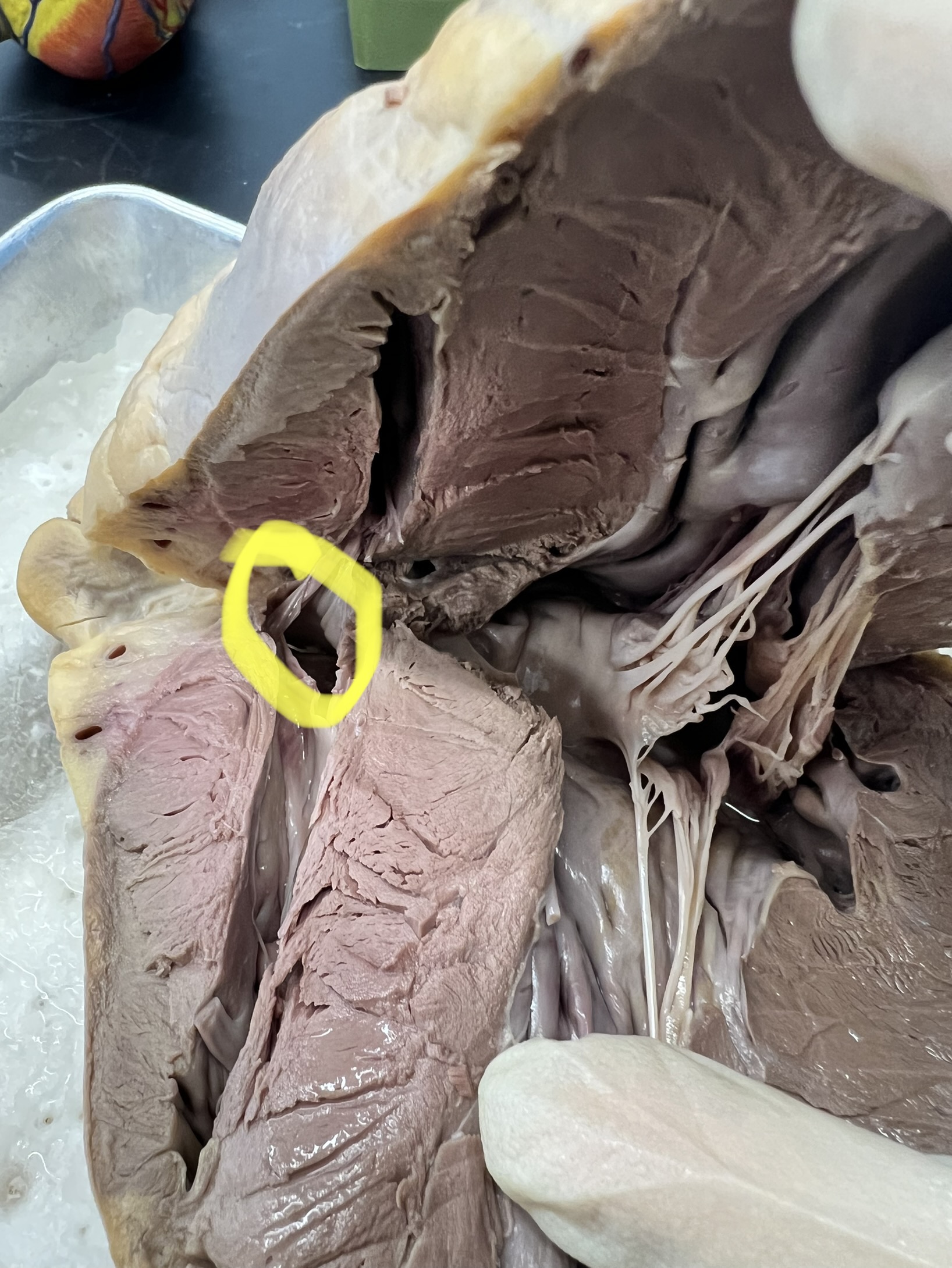 Name the heart structure.