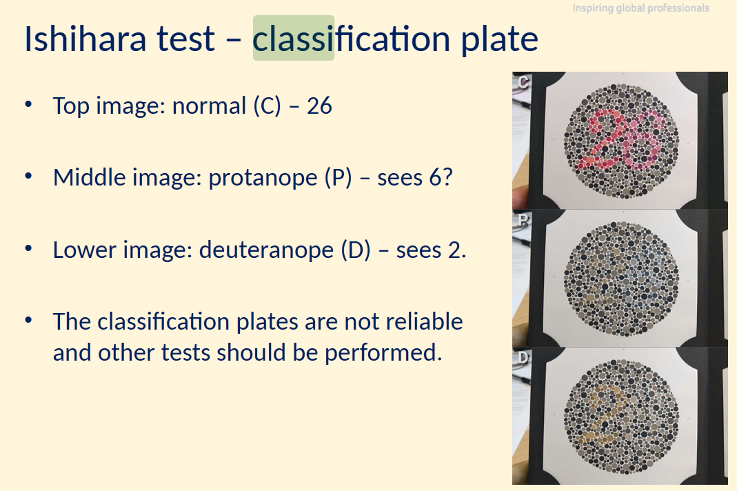 <p>not reliable + other tests should be performed</p><p><span>helps to know if they have a cvd and can kind of tell which cvd but you can’t rely on just that</span></p><p></p>