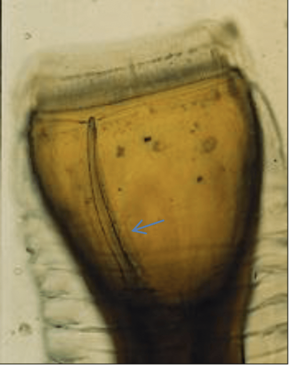 <p>What is this parasite? What characteristic/s did you use to identify it? (equine)</p>