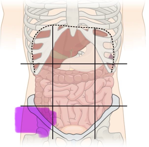 term image