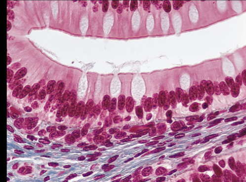 <p>what type of tissue is this</p>