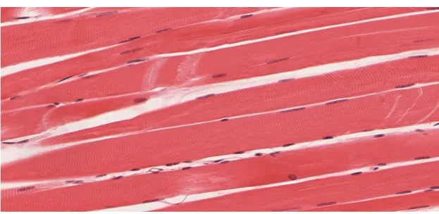 <p>stripes, long and cylindrical, peripherally located nuclei&nbsp;&nbsp;</p>