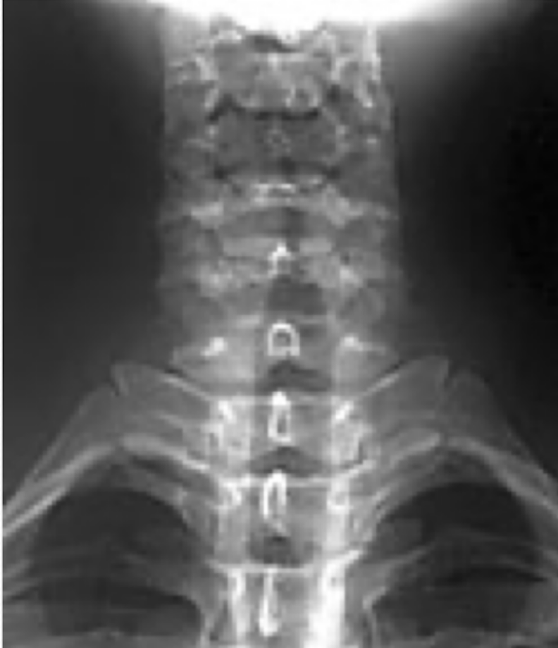 <p>What part of the spine is in this image?</p>