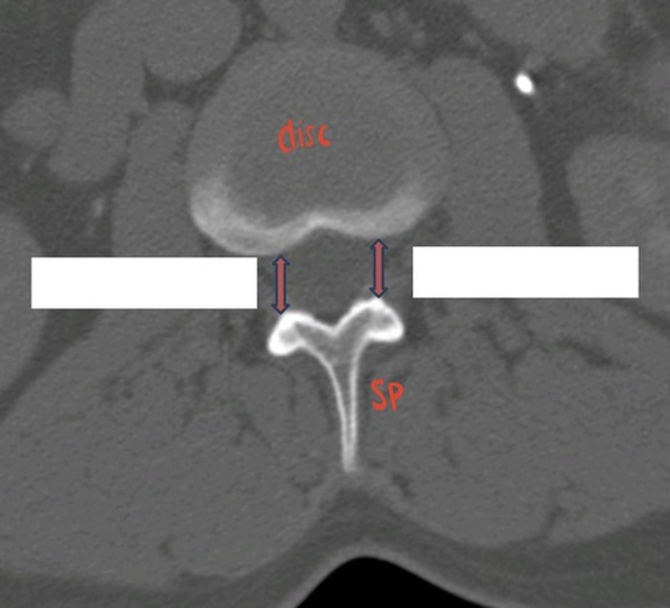 <p>what are the pink arrows, and what is noticeable about these?</p>