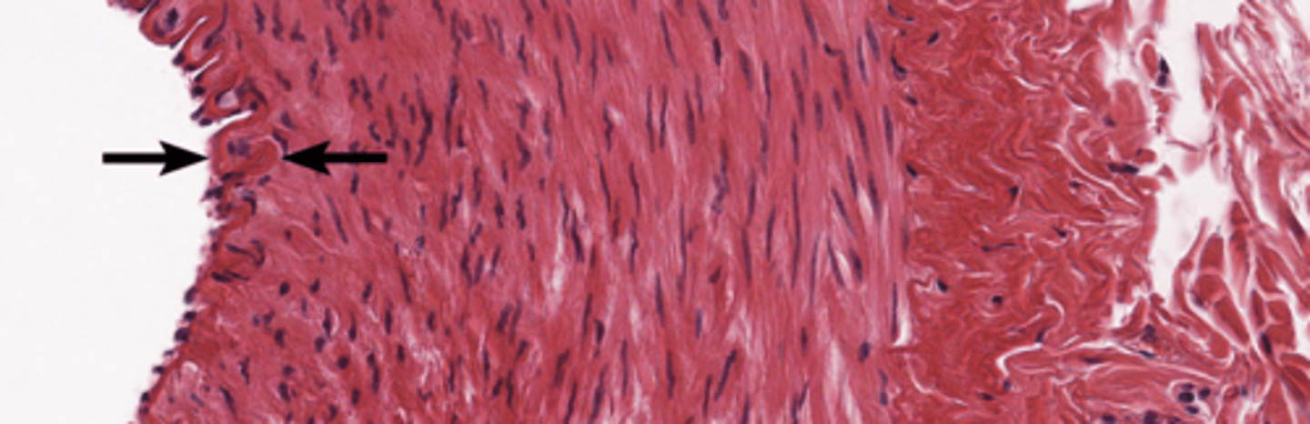 <p>Inner layer of endothelium that contains simple squamous cells</p>