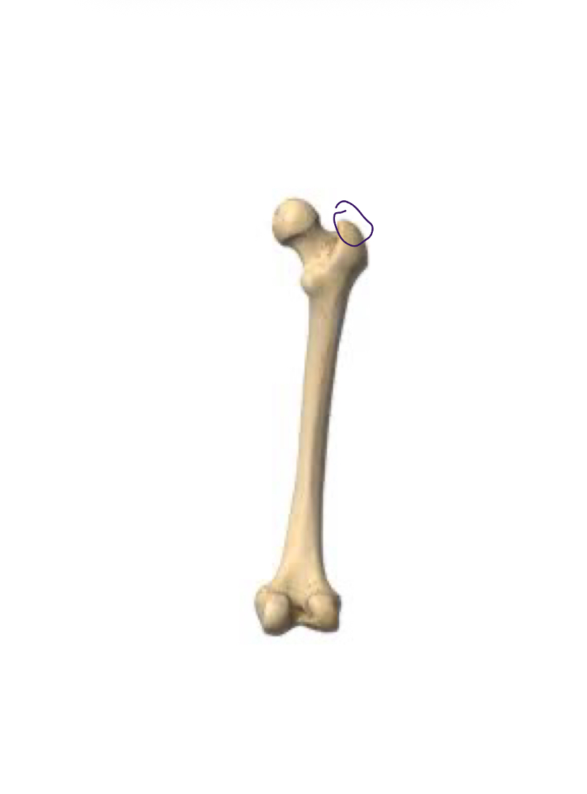 <p>Top of femur, next to head </p>
