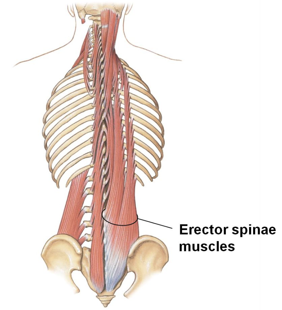 <ul><li><p>Extend and laterally (side to side) bend the neck and trunk</p></li><li><p>Grouping of 3 muscles</p></li></ul><p></p>