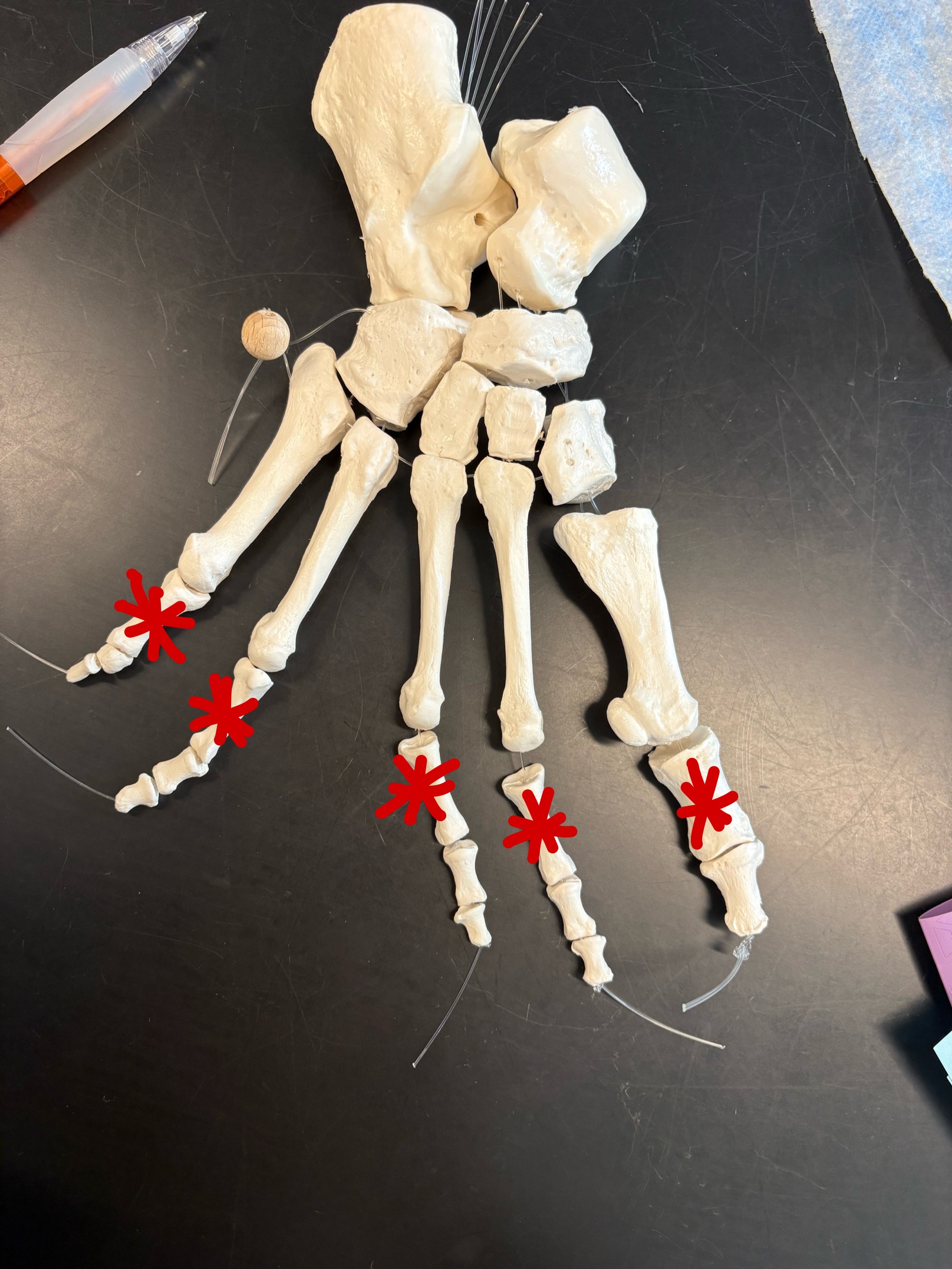 <p>Name these bones</p>