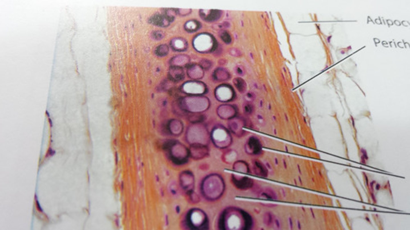 <p>membrane that covers cartilage</p>