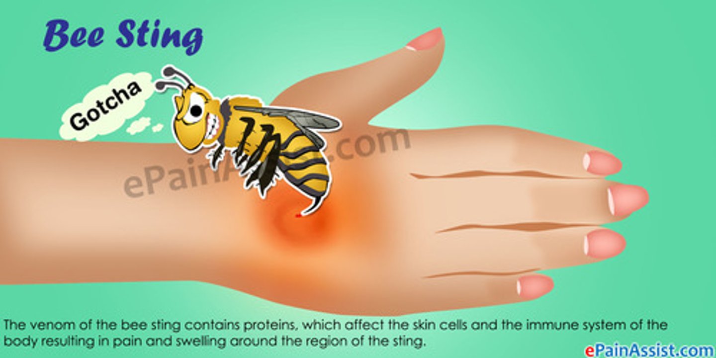 <p>- stinger present</p><p>- bite marks</p><p>- pain</p><p>- local swelling</p><p>- rash</p><p>- hives</p><p>- nausea</p><p>- difficulty breathing</p><p>- itchiness</p>