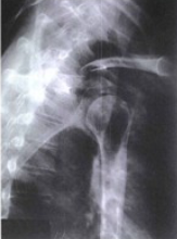 <p>name the x-ray/position/method&nbsp;</p>