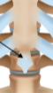<p>Xiphoid process</p>