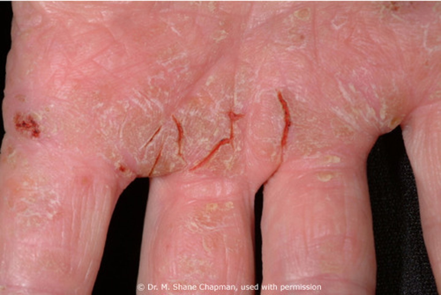 <p>affects the skin:</p><p>cut</p><p>sunburn</p>