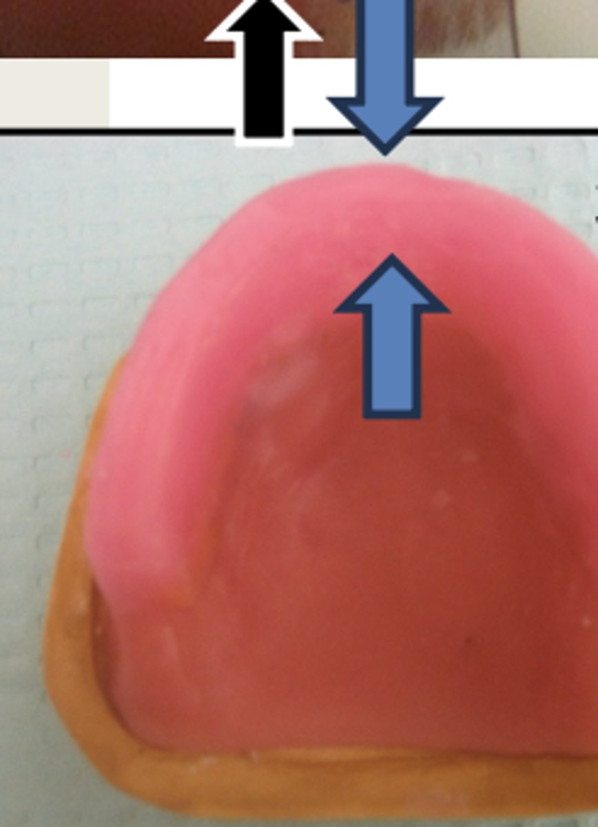 <p>For the fabrication of the maxillary wax rim, it should have a flat and smooth incisal plane which is __ mm wide (blue arrows)</p>
