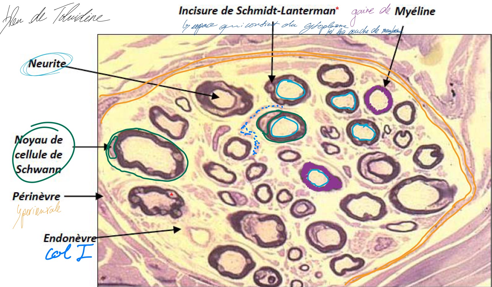 <p>MO, paraffine, bleu de toluidine </p><p>Incisure de Schmidt Lantermans </p><p>Neurites + gaine de myéline </p><p>Noyau de cellule Schwann </p><p>Périnèvre et Endonèvre </p>